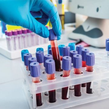 Laboratorio Analisi Sassari: Apertura del Nuovo Bio Clinic con Servizi Avanzati per la Salute